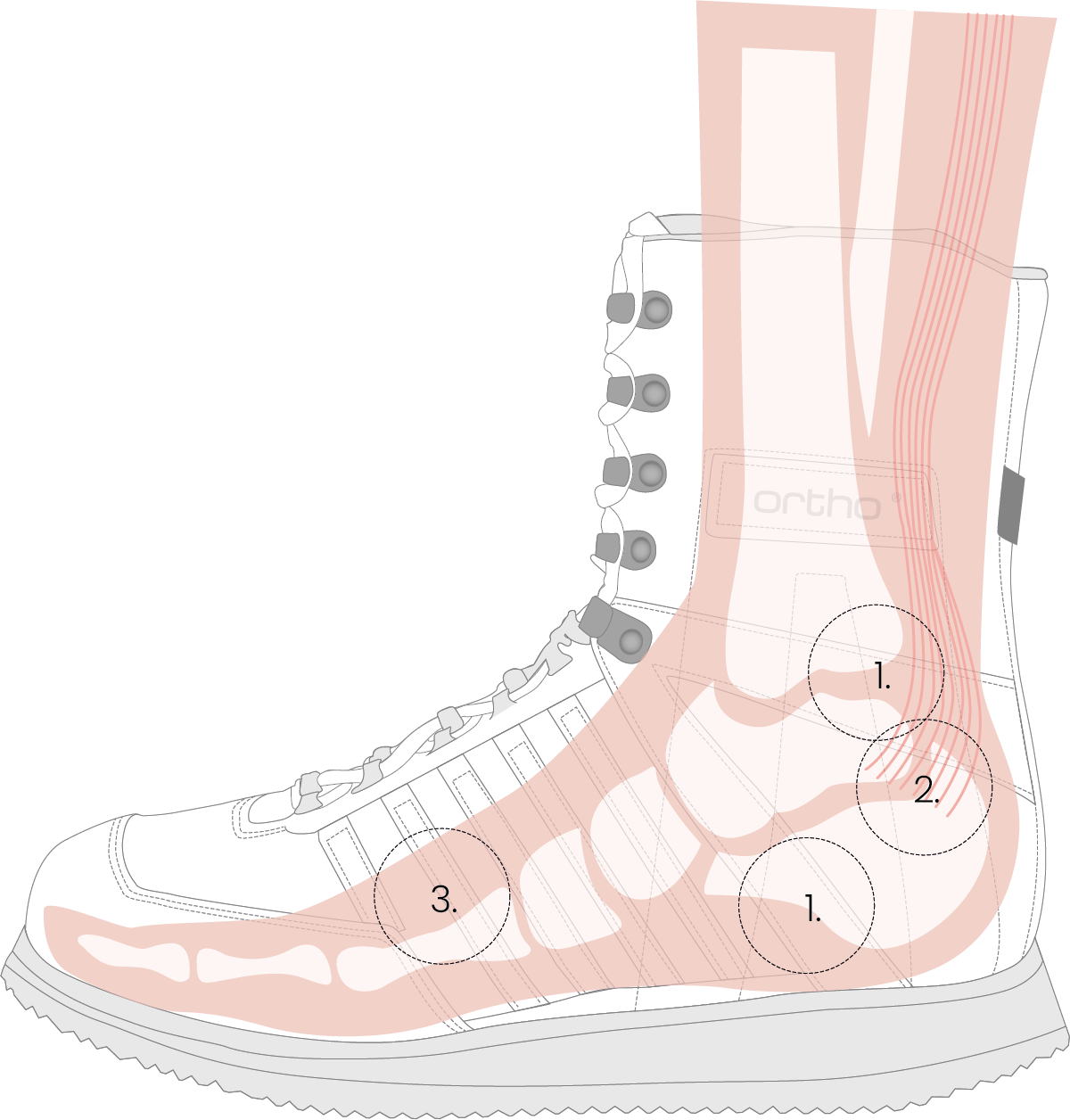 Illustration eines orthopädischen Stiefels von Kuenzli Schuhe mit anatomischen Fußdetails.