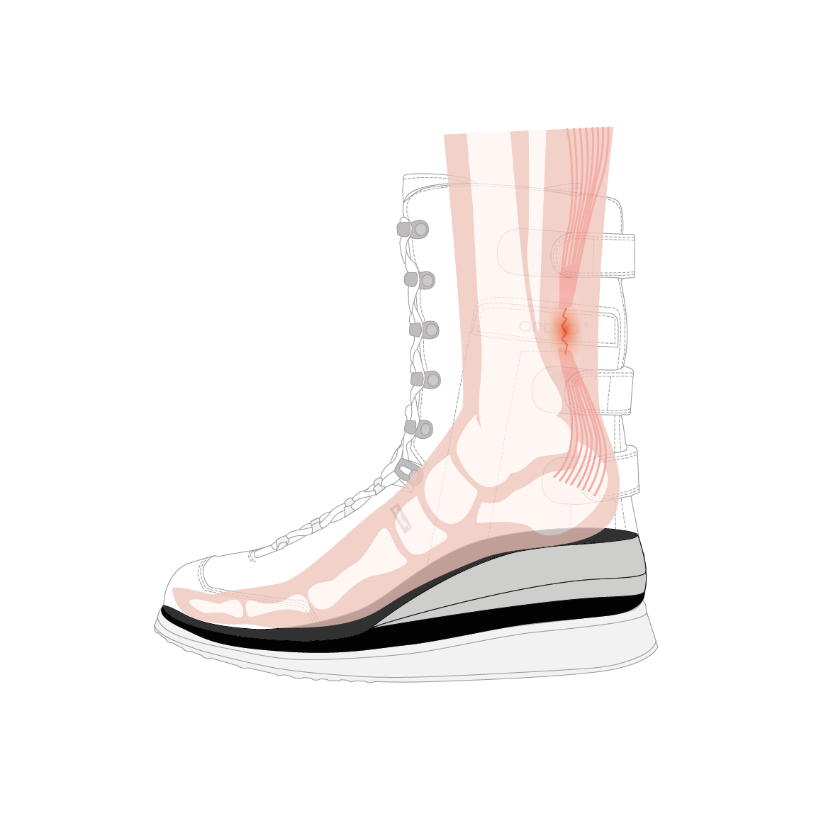 Illustration Künzli Schuh mit Keilen bei Achillessehnenverletzung