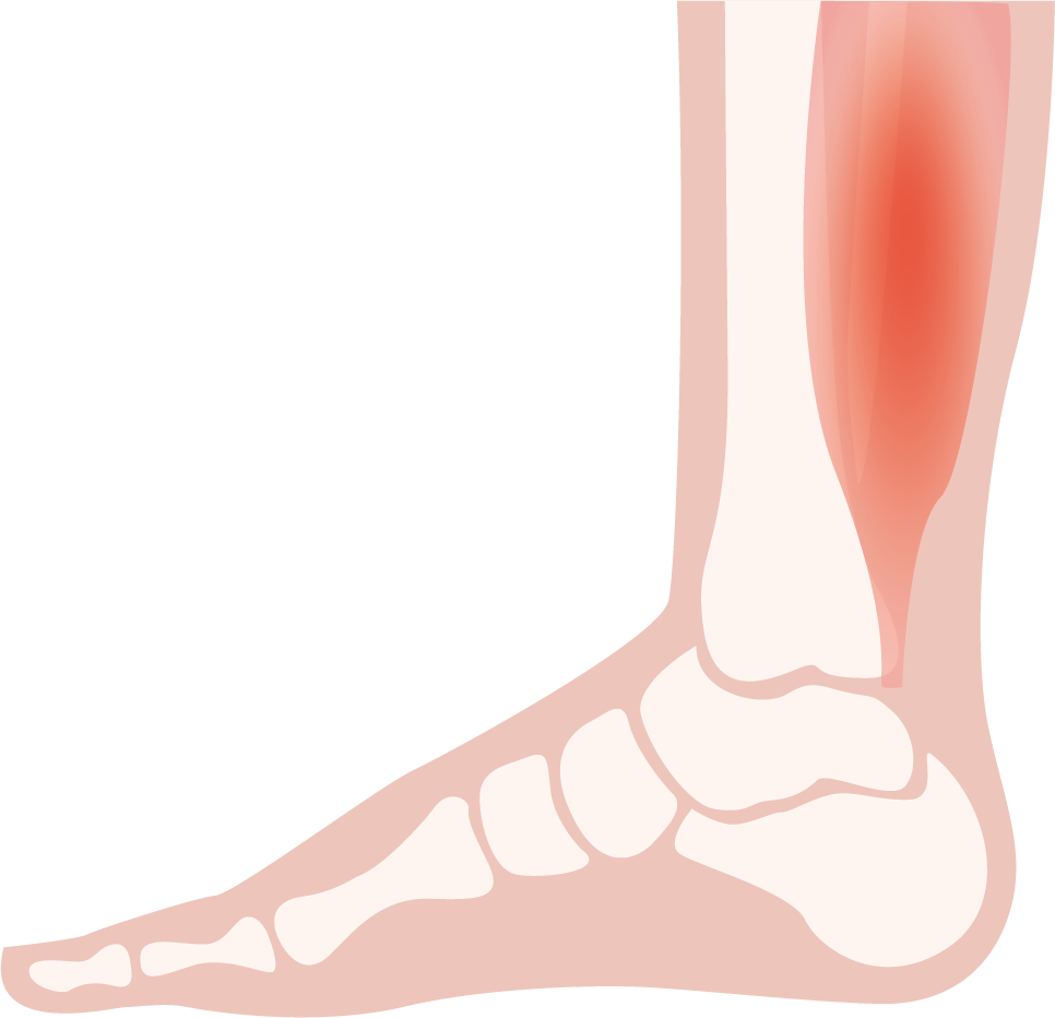 Illustration eines Fußes mit hervorgehobenem Muskel, passend für Kuenzli Schuhe.