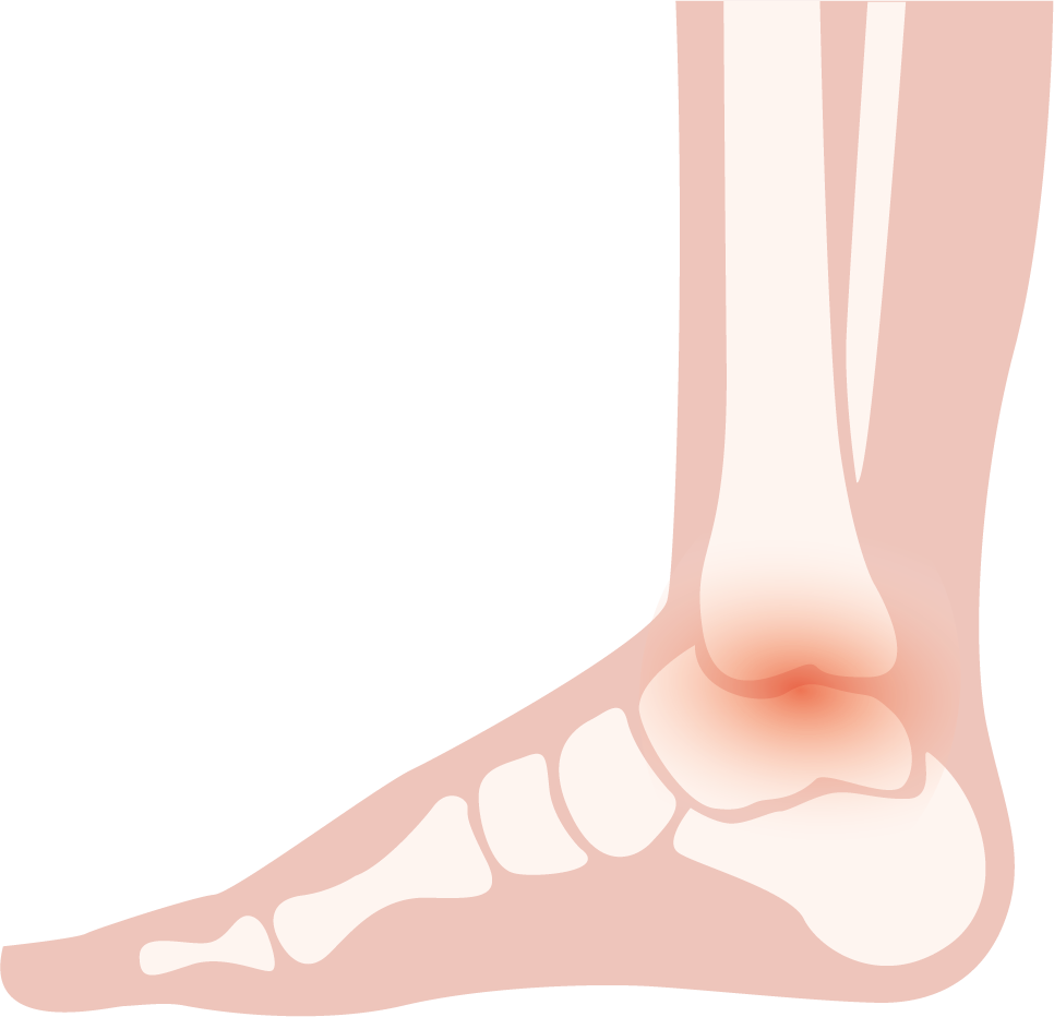 Illustration eines Sprunggelenks mit roter Markierung, passend für Kuenzli Schuhe.